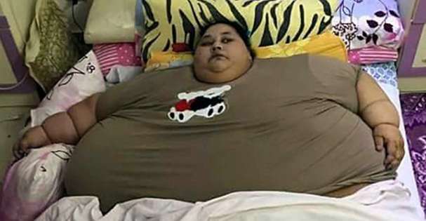 6 ತಿಂಗಳಲ್ಲಿ ಇಮಾನ್‌ಳ ತೂಕವನ್ನು 200 ಕೆ.ಜಿ. ಕಡಿಮೆ ಮಾಡುತ್ತೇವೆ: ವೈದ್ಯರು